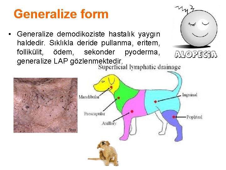 Generalize form • Generalize demodikoziste hastalık yaygın haldedir. Sıklıkla deride pullanma, eritem, follikülit, ödem,