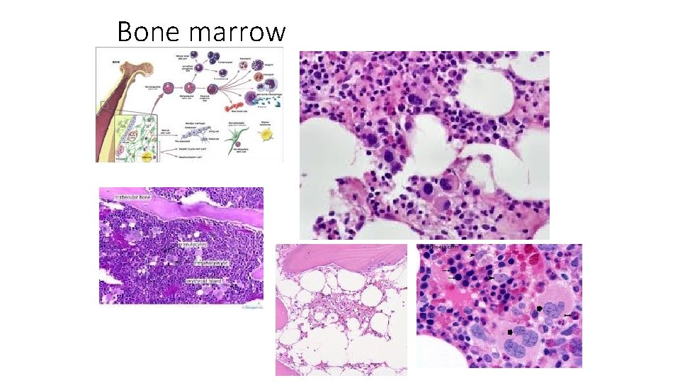 Bone marrow 