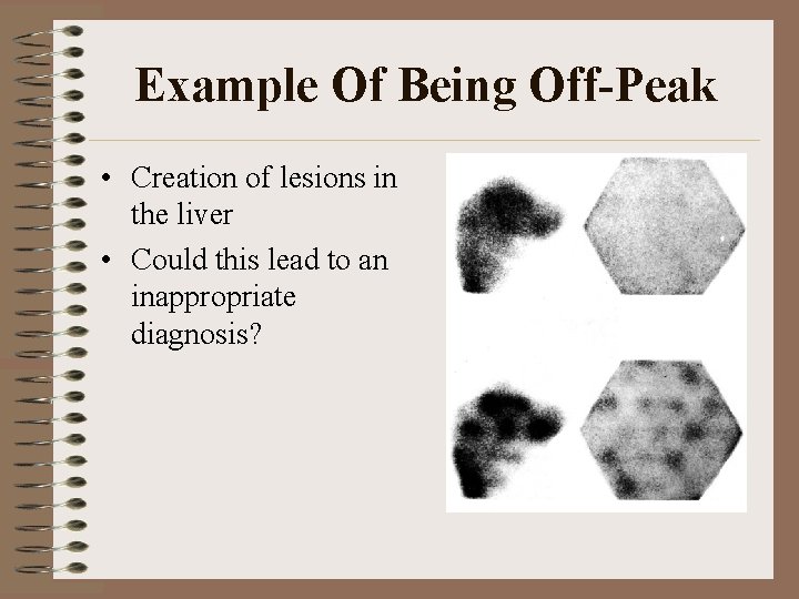 Example Of Being Off-Peak • Creation of lesions in the liver • Could this