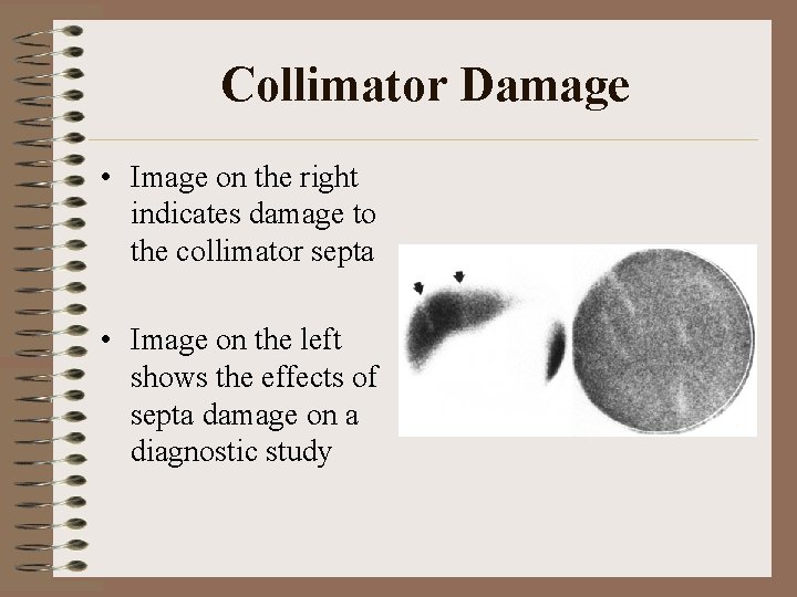 Collimator Damage • Image on the right indicates damage to the collimator septa •