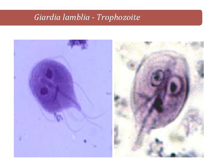 Giardia lamblia - Trophozoite 
