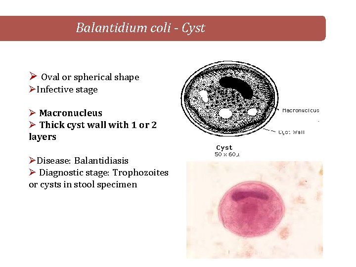 Balantidium coli - Cyst Ø Oval or spherical shape ØInfective stage Ø Macronucleus Ø