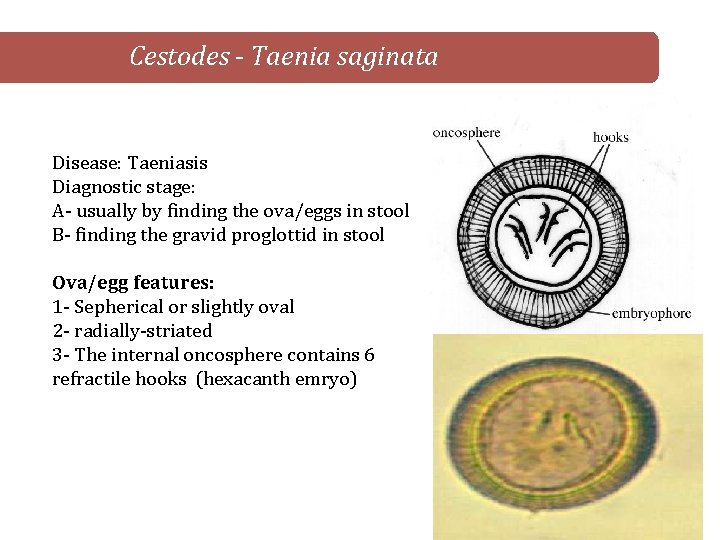 Cestodes - Taenia saginata Disease: Taeniasis Diagnostic stage: A- usually by finding the ova/eggs