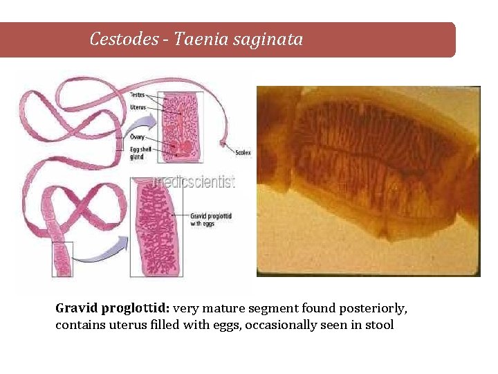 Cestodes - Taenia saginata Gravid proglottid: very mature segment found posteriorly, contains uterus filled