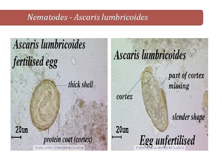 Nematodes - Ascaris lumbricoides 