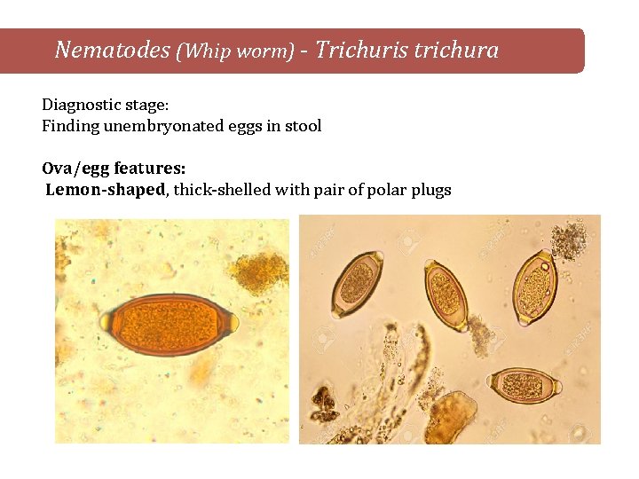 Nematodes (Whip worm) - Trichuris trichura Diagnostic stage: Finding unembryonated eggs in stool Ova/egg