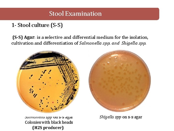  Stool Examination 1 - Stool culture (S-S) Agar: is a selective and differential