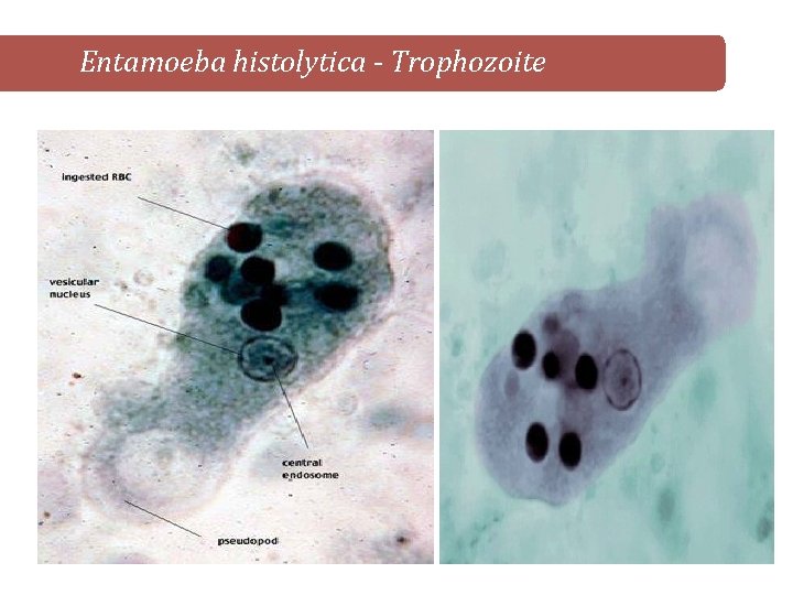 Entamoeba histolytica - Trophozoite 