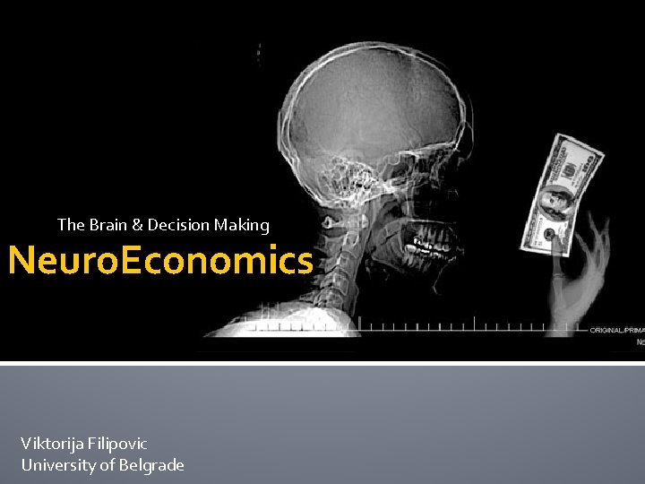 The Brain & Decision Making Neuro. Economics Viktorija Filipovic University of Belgrade 