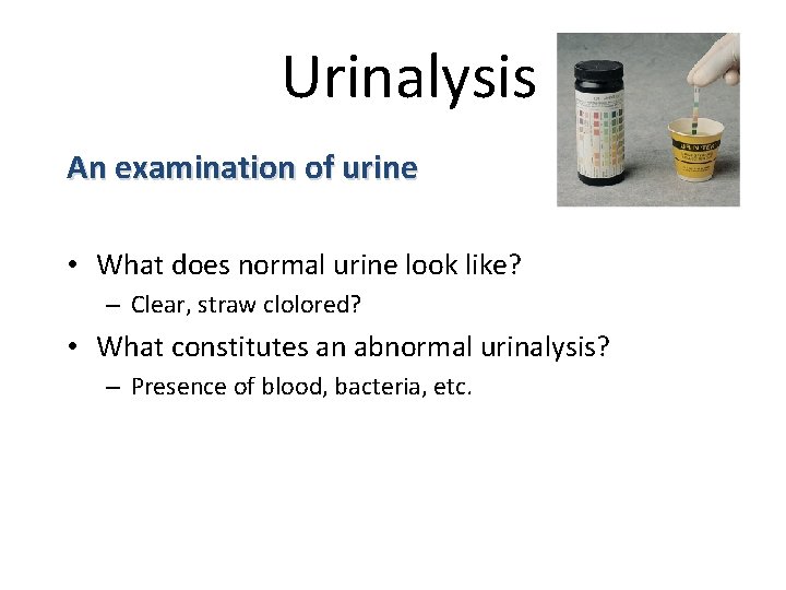 Urinalysis An examination of urine • What does normal urine look like? – Clear,