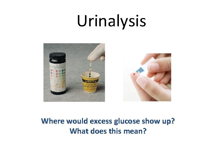 Urinalysis Where would excess glucose show up? What does this mean? 