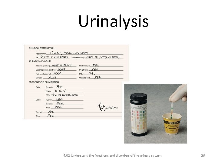 Urinalysis 4. 02 Understand the functions and disorders of the urinary system 36 