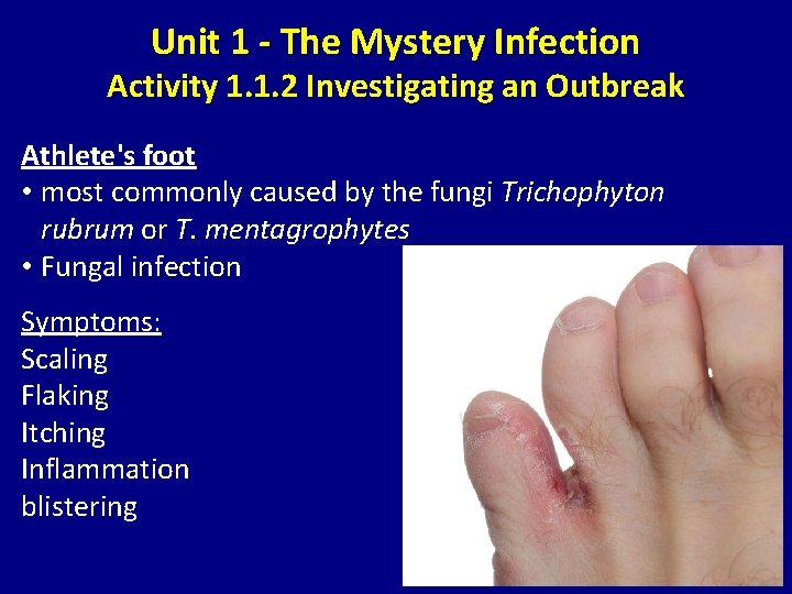 Unit 1 - The Mystery Infection Activity 1. 1. 2 Investigating an Outbreak Athlete's