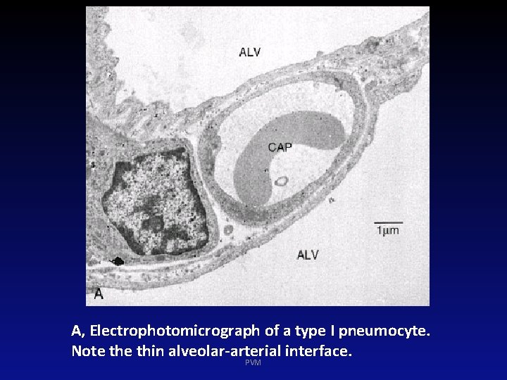 A, Electrophotomicrograph of a type I pneumocyte. Note thin alveolar-arterial interface. PVM 
