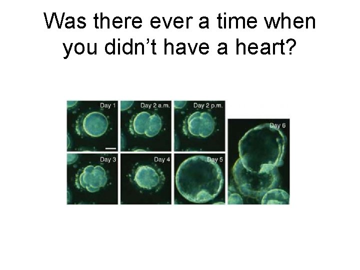 Was there ever a time when you didn’t have a heart? 