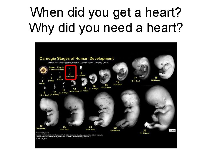 When did you get a heart? Why did you need a heart? 