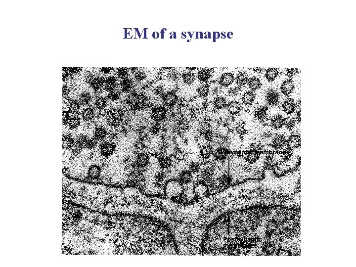 EM of a synapse 