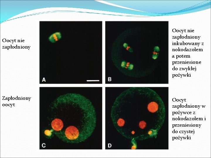 Oocyt nie zapłodniony Zapłodniony oocyt Oocyt nie zapłodniony inkubowany z nokodazolem a potem przeniesione