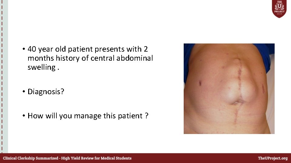  • 40 year old patient presents with 2 months history of central abdominal