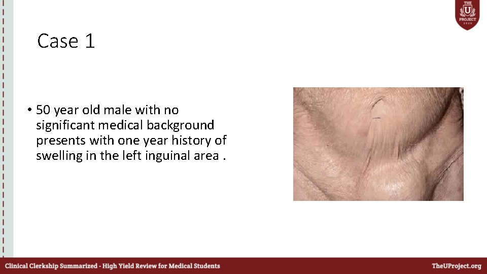 Case 1 • 50 year old male with no significant medical background presents with