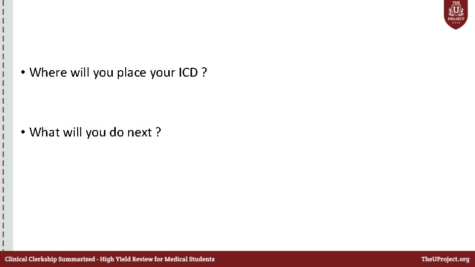  • Where will you place your ICD ? • What will you do