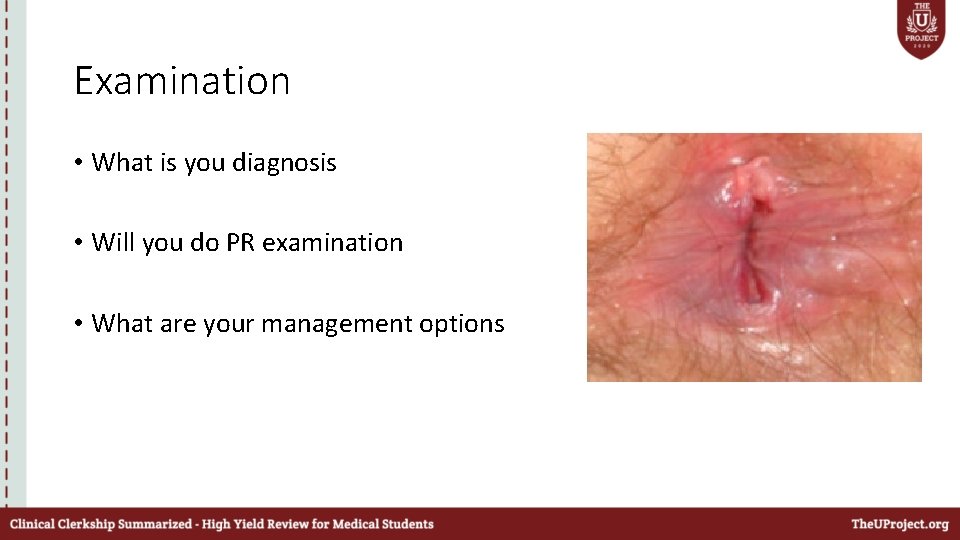 Examination • What is you diagnosis • Will you do PR examination • What