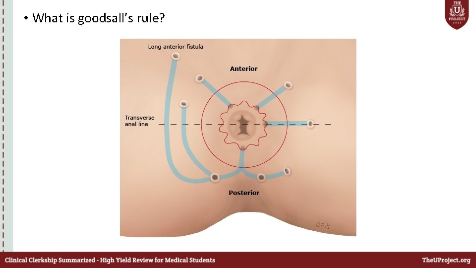  • What is goodsall’s rule? 