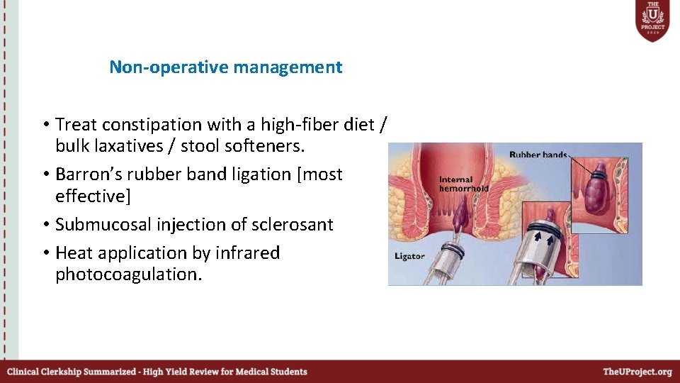 Non-operative management • Treat constipation with a high-fiber diet / bulk laxatives / stool