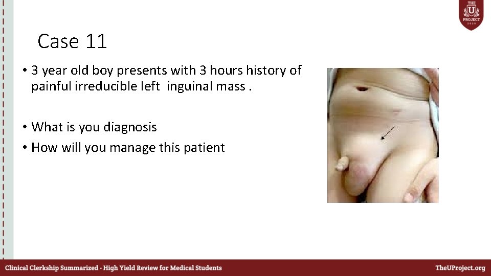 Case 11 • 3 year old boy presents with 3 hours history of painful