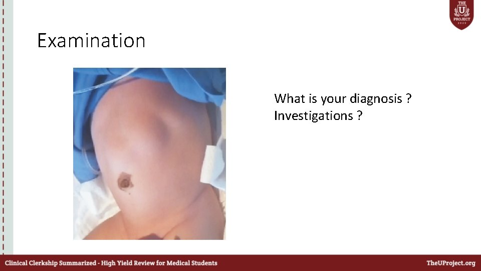 Examination What is your diagnosis ? Investigations ? 