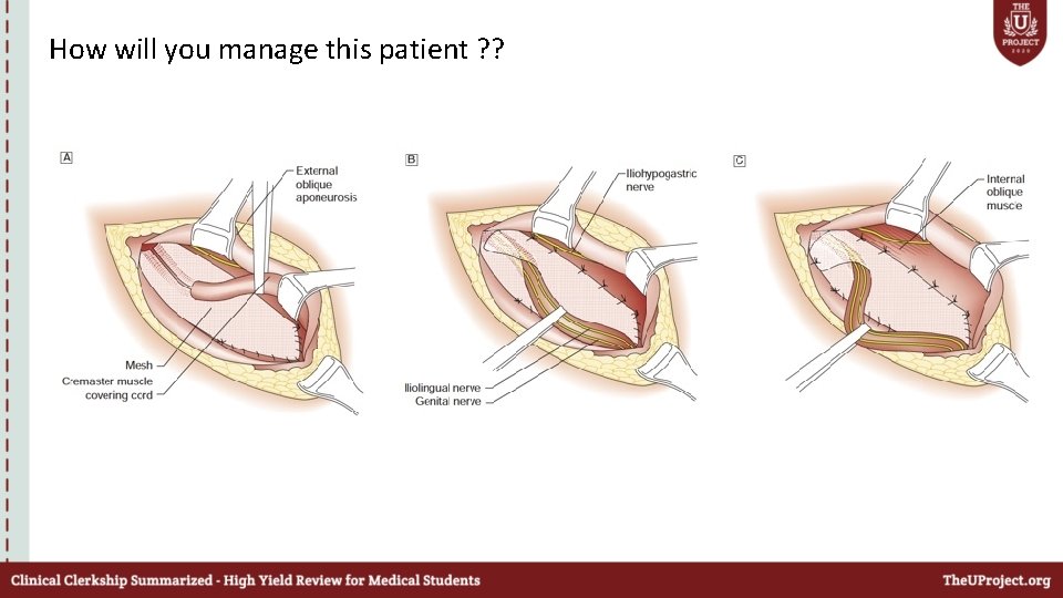 How will you manage this patient ? ? 