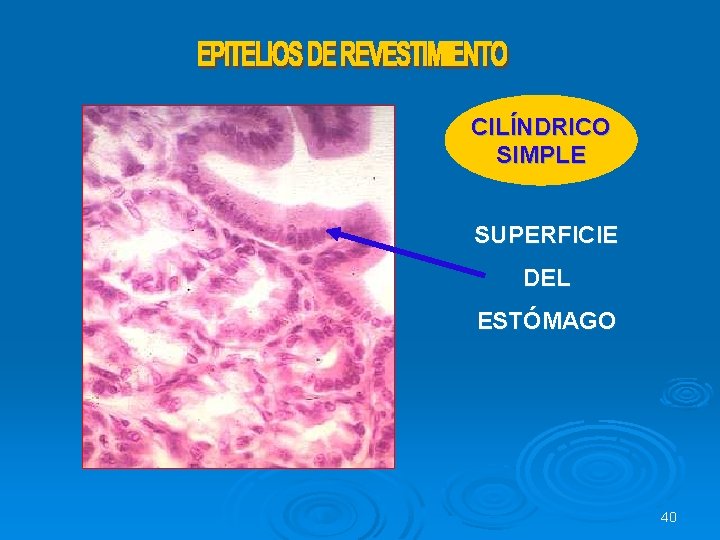 CILÍNDRICO SIMPLE SUPERFICIE DEL ESTÓMAGO 40 