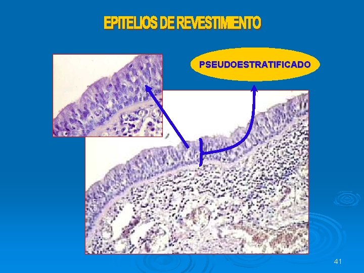 PSEUDOESTRATIFICADO 41 