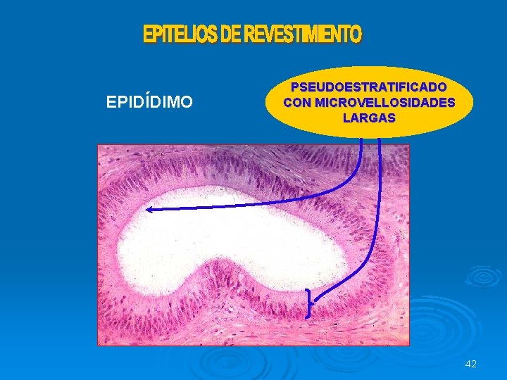 EPIDÍDIMO PSEUDOESTRATIFICADO CON MICROVELLOSIDADES LARGAS 42 