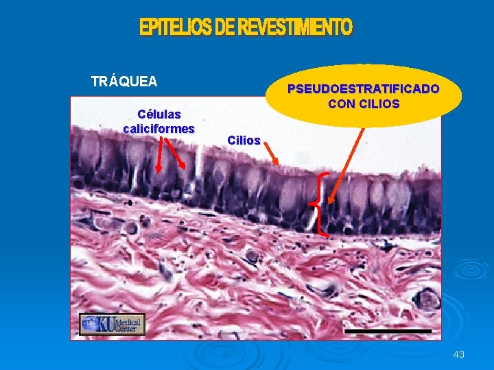 TRÁQUEA Células caliciformes PSEUDOESTRATIFICADO CON CILIOS Cilios 43 