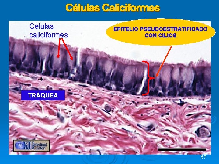 Células caliciformes EPITELIO PSEUDOESTRATIFICADO CON CILIOS TRÁQUEA 57 