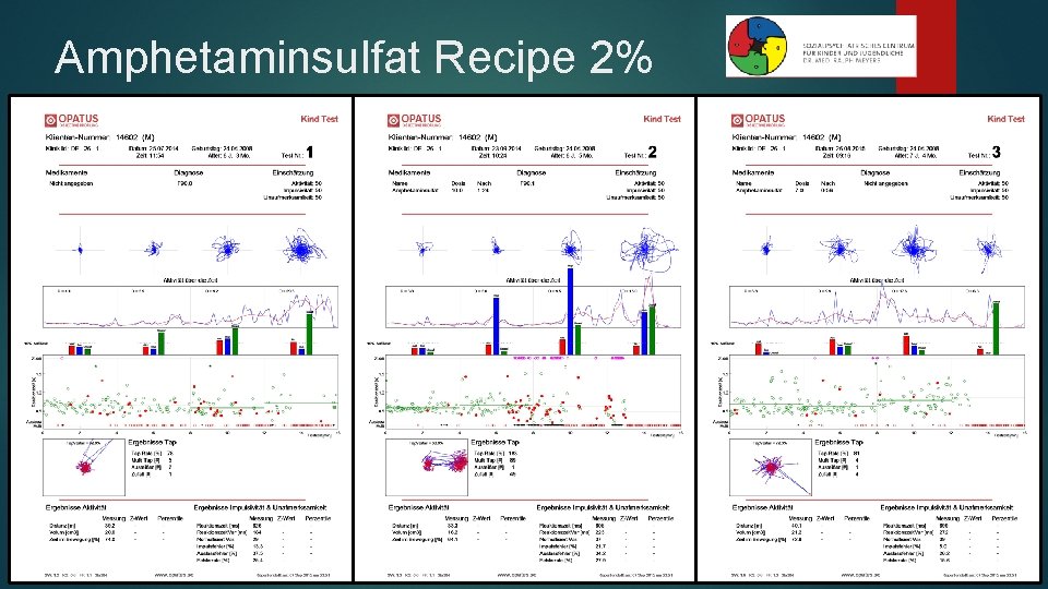 Amphetaminsulfat Recipe 2% 