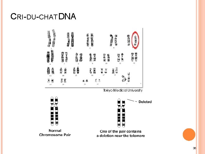 CRI-DU-CHAT DNA 36 