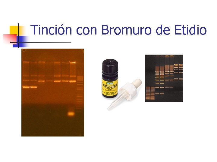 Tinción con Bromuro de Etidio 