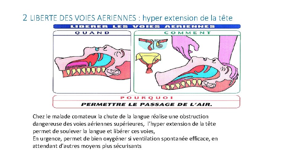 2 LIBERTE DES VOIES AERIENNES : hyper extension de la tête Chez le malade 2 LIBERTE DES VOIES AERIENNES : hyper extension de la tête Chez le malade