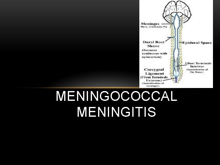 MENINGOCOCCAL MENINGITIS 