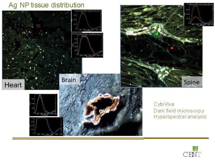 Ag NP tissue distribution Cyto. Viva Dark field microscopy Hyperspectral analysis '" CEINT 