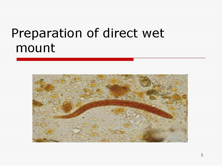 Preparation of direct wet mount 1 