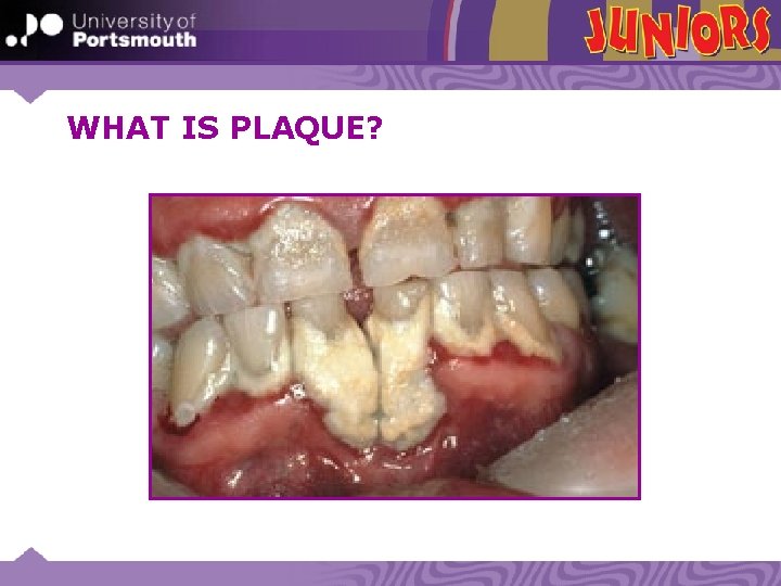 WHAT IS PLAQUE? 