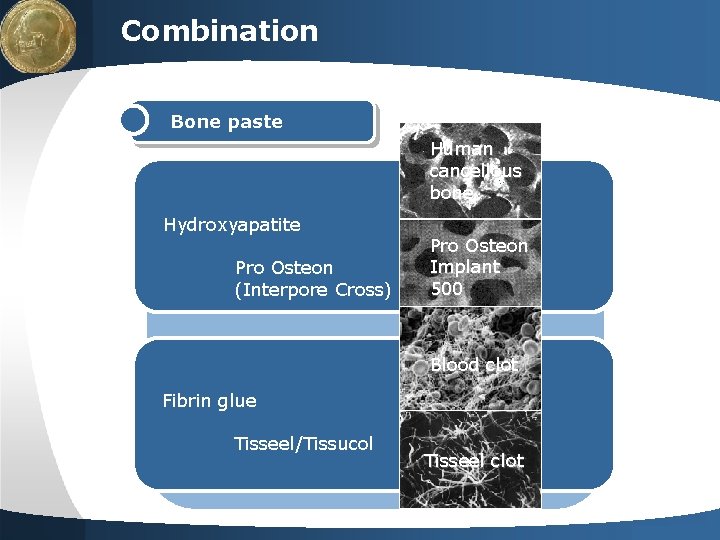 LOGO Combination Bone paste Human cancellous bone Hydroxyapatite Pro Osteon (Interpore Cross) Pro Osteon