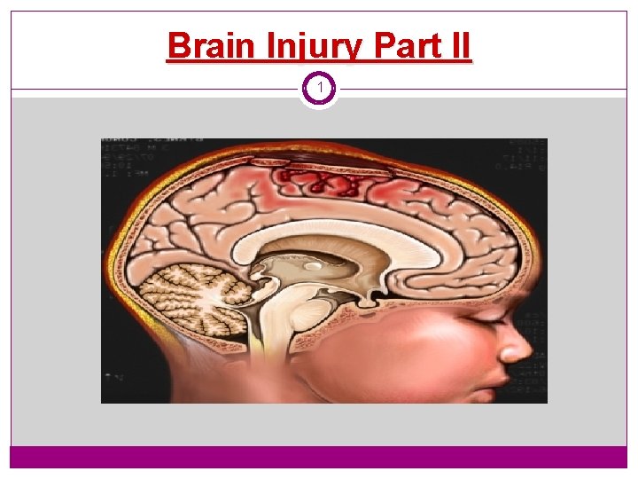 Brain Injury Part II 1 