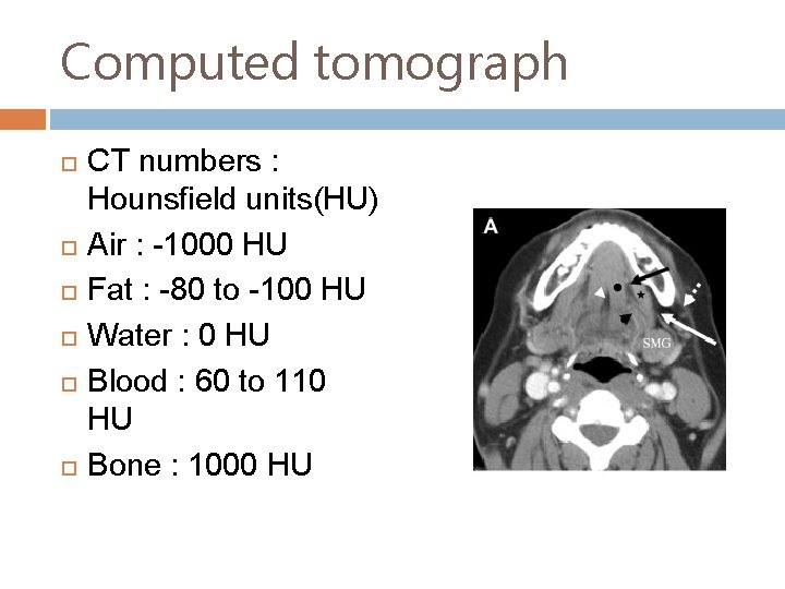 Computed tomograph CT numbers : Hounsfield units(HU) Air : -1000 HU Fat : -80