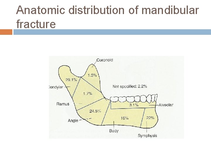 Anatomic distribution of mandibular fracture 