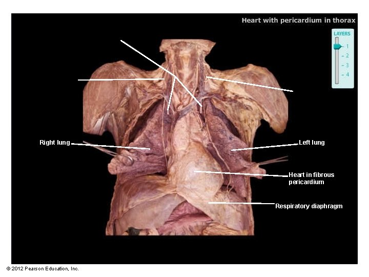 Right lung Left lung Heart in fibrous pericardium Respiratory diaphragm © 2012 Pearson Education,