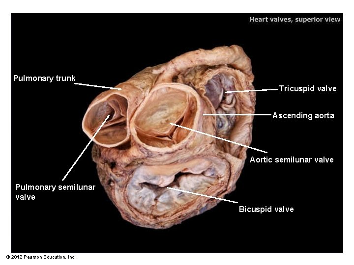 Pulmonary trunk Tricuspid valve Ascending aorta Aortic semilunar valve Pulmonary semilunar valve Bicuspid valve